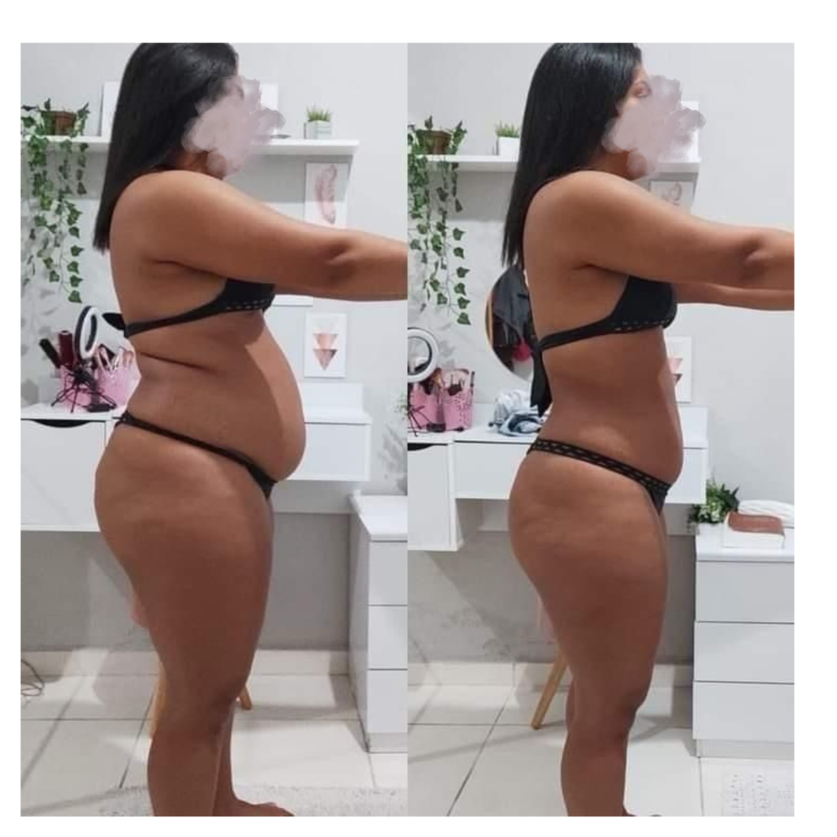Non Invasive Body Sculpting
